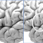 Neuroscientific Mechanisms Behind TMS Therapy And How It Affects Brain Activity And Neurotransmitter Levels: