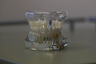 Dentures vs. Dental Implants: What’s Right for You