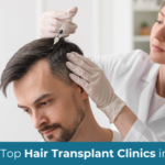 hair transplant