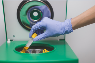 Synthetic Urine vs. Real Urine: Can Labs Tell the Difference?