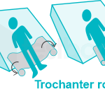 Who Can Benefit from a Trochanter Roll?