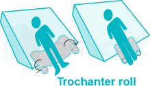 Who Can Benefit from a Trochanter Roll?