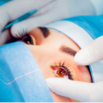 Eye Surgery - What are the Procedures Now Available for You in London?