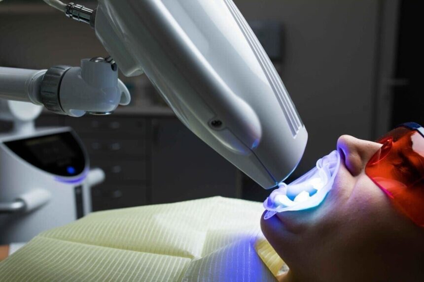 Professional Teeth Whitening Light: A Game-Changer for Dental Clinics