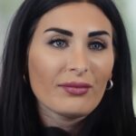 laura loomer nose surgery