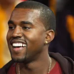 kanye west teeth