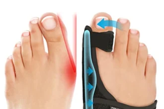 bunion corrector