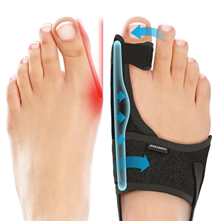 bunion corrector