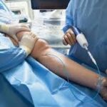 The Benefits of Minimally Invasive Vein Treatments