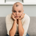 What Are the Signs of Alopecia?