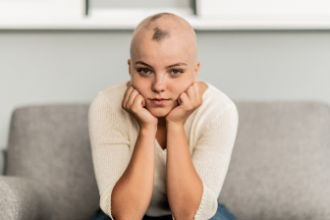 What Are the Signs of Alopecia?