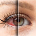Digital Eye Strain, Daily Lenses & Dry Eyes: Managing Modern Eye Stress