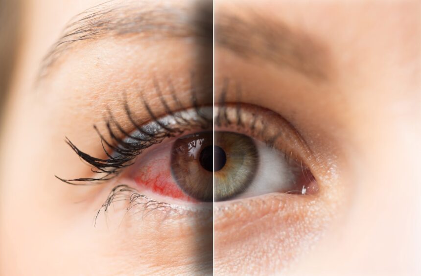 Digital Eye Strain, Daily Lenses & Dry Eyes: Managing Modern Eye Stress