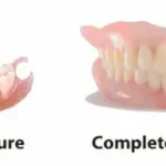 How Technology Helps Produce Partial Dentures