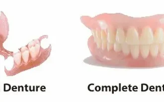 How Technology Helps Produce Partial Dentures