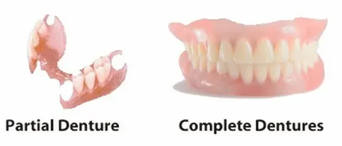 How Technology Helps Produce Partial Dentures