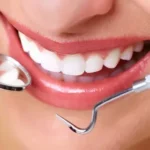 Smile Makeovers