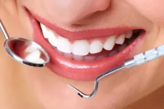 Smile Makeovers