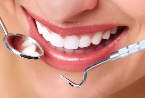 Smile Makeovers