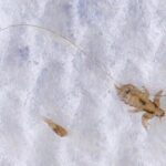 Super Lice Are No Match: The Proven Removal Methods That Work the First Time