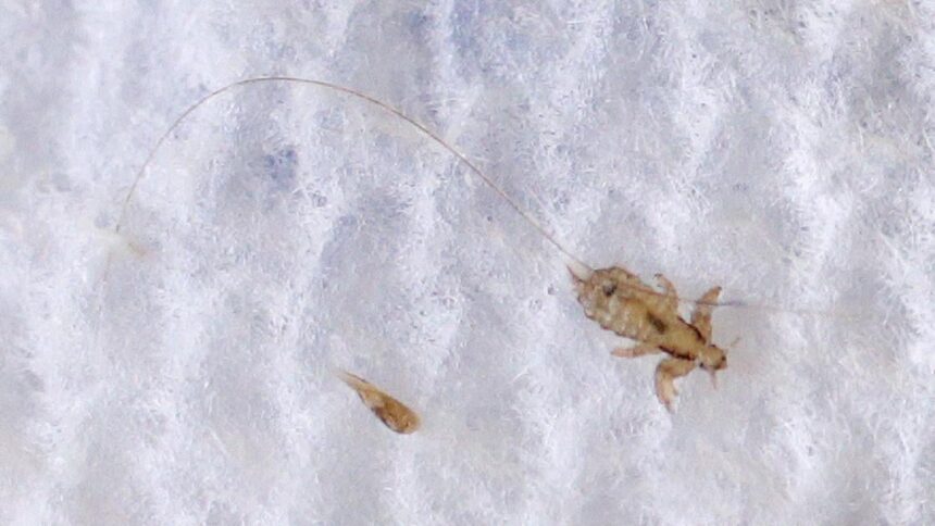 Super Lice Are No Match: The Proven Removal Methods That Work the First Time