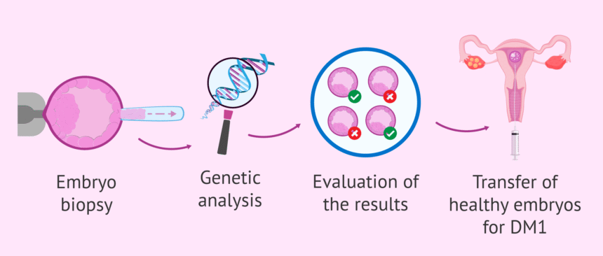 Preimplantation Genetic