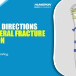 Fracture