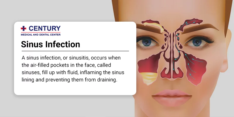 is a sinus infection contagious