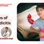 4 stages of appendicitis
