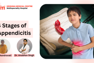 4 stages of appendicitis