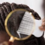 can black people get lice