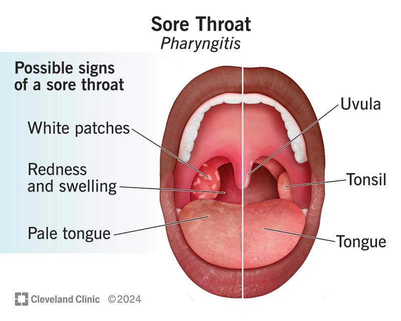 sourthrout