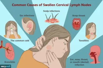 cold compress for swollen lymph nodes